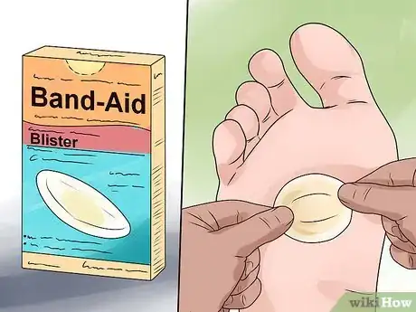 Imagen titulada Care for a Burst Blister Step 7