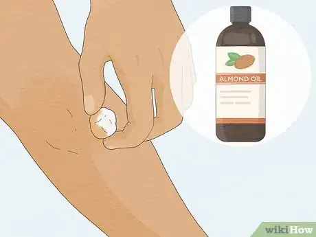 Imagen titulada Clean Your Elbows Step 7