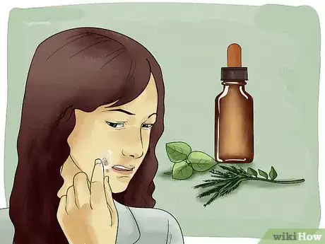 Imagen titulada Get Rid of a Cold Sore with Home Remedies Step 6