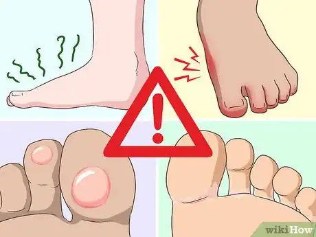 Imagen titulada Treat Tinea Step 1