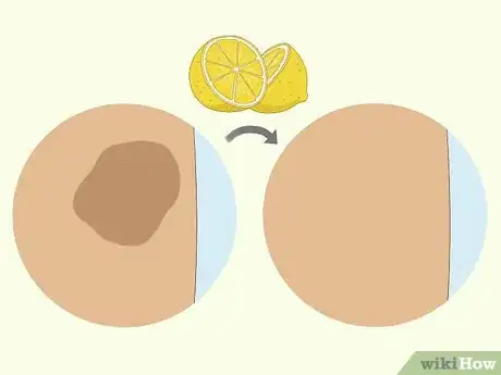 Imagen titulada Use a Lemon to Lighten Your Skin Step 2