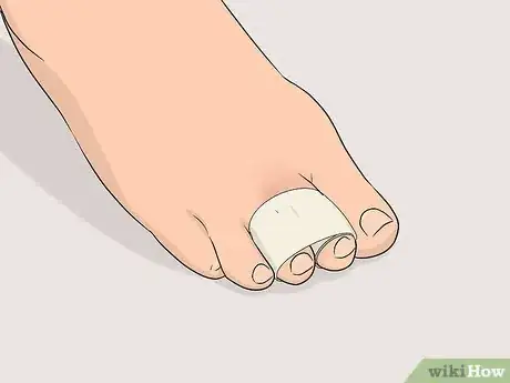 Imagen titulada Buddy Tape an Injured Toe Step 3