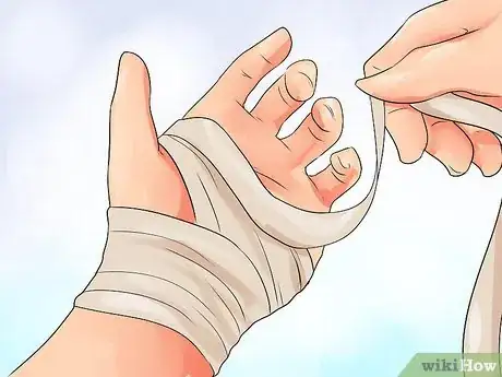 Imagen titulada Exercise After Carpal Tunnel Surgery Step 7