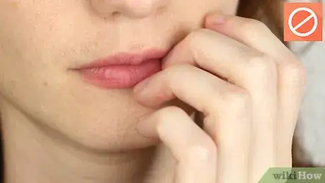 Imagen titulada Get Rid of Hangnails Step 7