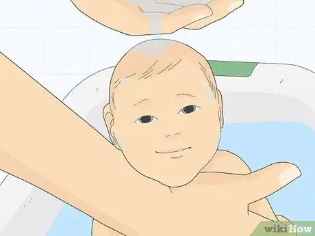Imagen titulada Treat Baby Heat Rash Step 1