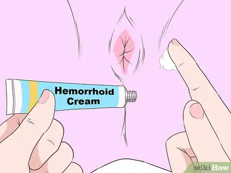 Imagen titulada Stop Rectal Bleeding Step 12