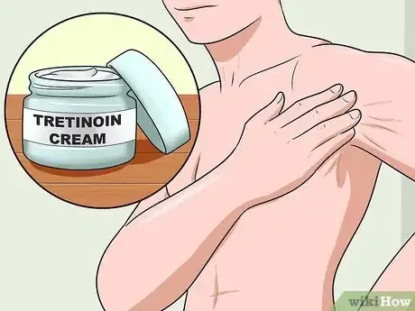 Imagen titulada Get Rid of Stretch Marks Fast Step 10