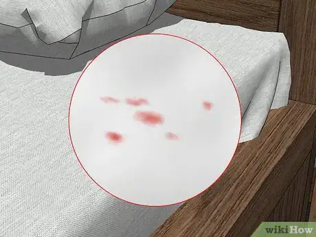 Imagen titulada Check for Bedbugs Step 3