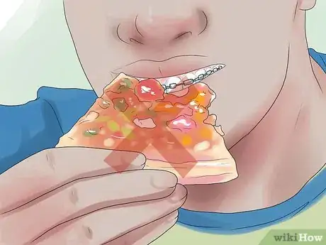 Imagen titulada Eat With Braces Step 6