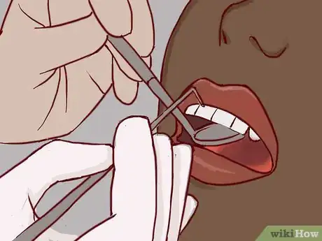 Imagen titulada Treat a Broken Tooth Step 15