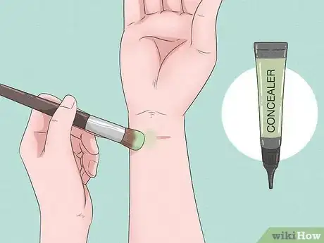 Imagen titulada Hide Self Harm Scars Step 1