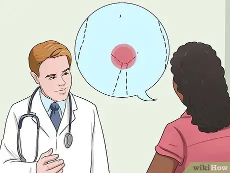 Imagen titulada Stop Vaginal Itching Step 14