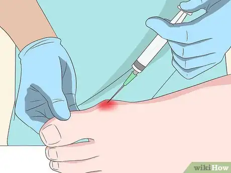 Imagen titulada Stop a Bunion from Growing Step 12