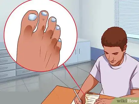 Imagen titulada Diagnose Lupus Step 8