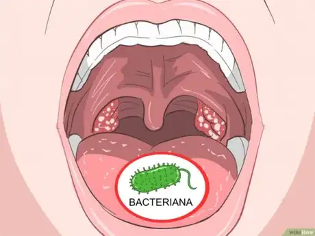 Imagen titulada Tell_a_Viral_from_a_Bacterial_Infection_Step_3