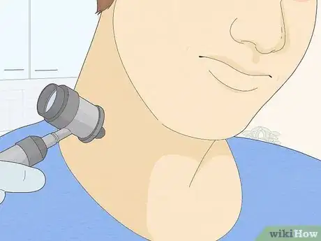 Imagen titulada Remove a Mole with Iodine Step 4