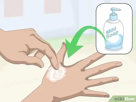 Imagen titulada Remove Tar From Skin Step 7