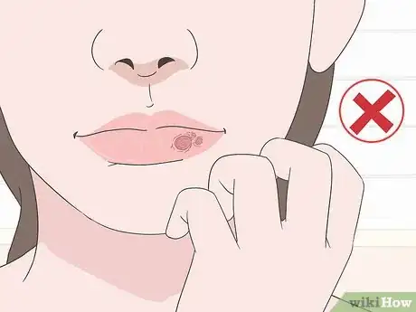 Imagen titulada Cover Up a Cold Sore Step 5