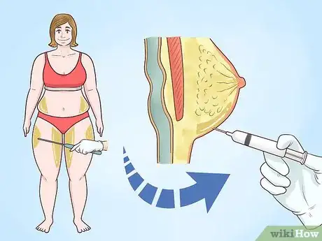 Imagen titulada Fix Imbalanced Breast Sizes Step 3