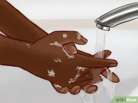 Imagen titulada Deal With a Cat Scratch Step 5