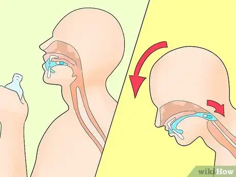 Imagen titulada Swallow a Pill Step 13