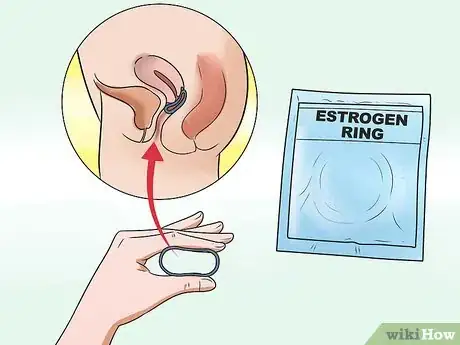 Imagen titulada Stop Vaginal Itching Step 18
