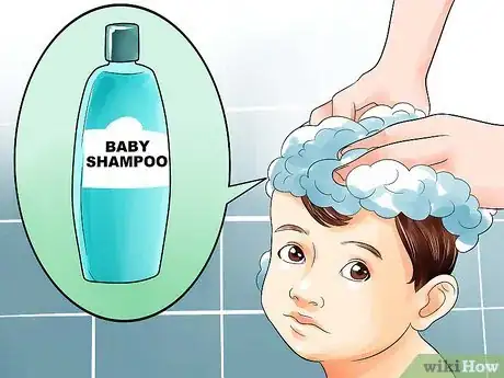 Imagen titulada Easily Clean Baby's Cradle Cap Dandruff Without Hurting the Baby Step 2