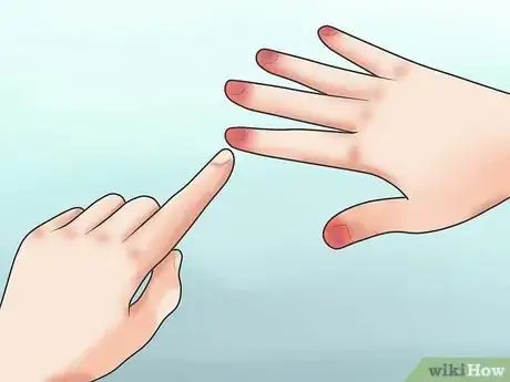 Imagen titulada Prevent Frostbite Step 21