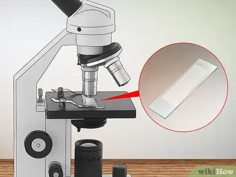 Imagen titulada Know if You Have Dust Mites Step 3