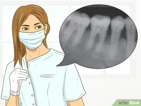 Imagen titulada Know if Your Dental Fillings Need Replacing Step 13
