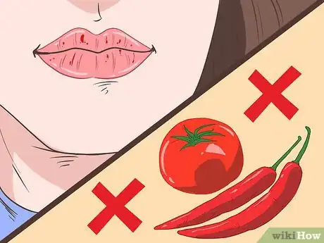 Imagen titulada Prevent Dry Chapped Lips Step 11