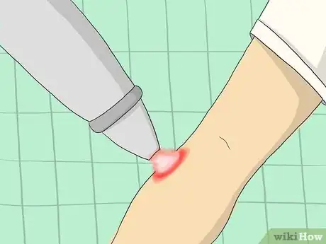 Imagen titulada Reduce Keratin in Skin Step 3