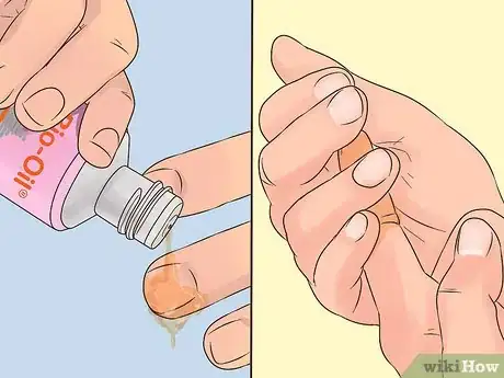 Imagen titulada Use Bio Oil Step 10