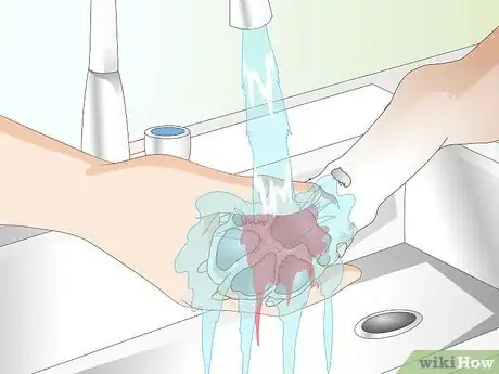 Imagen titulada Care for a Dog's Torn Paw Pad Step 5