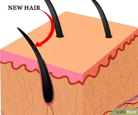 Imagen titulada Use Rogaine Step 11