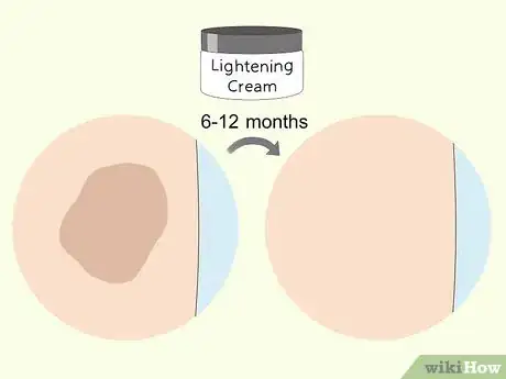 Imagen titulada Use a Lemon to Lighten Your Skin Step 6