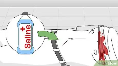 Imagen titulada Attend to a Stab Wound Step 15