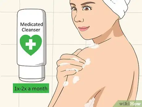 Imagen titulada Treat Tinea Step 14