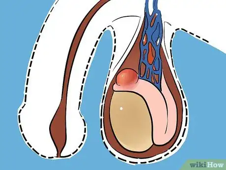 Imagen titulada Treat a Cyst Step 7