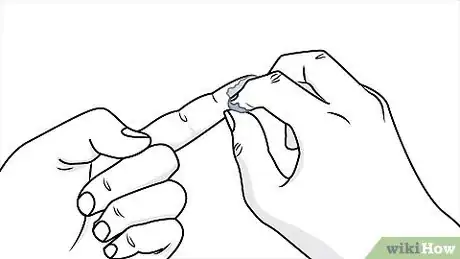 Imagen titulada Remove Super Glue Step 1