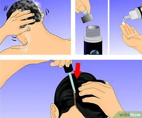 Imagen titulada Use Rogaine Step 6
