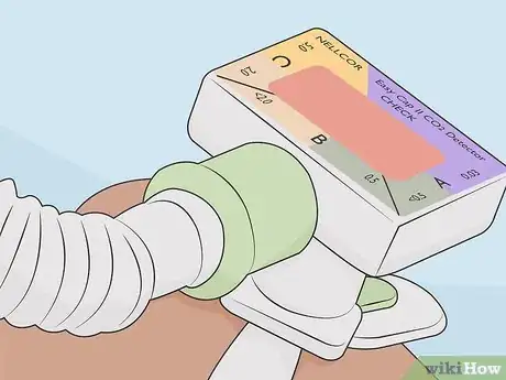 Imagen titulada Measure an ET Tube Step 13