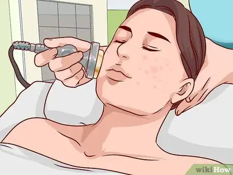 Imagen titulada Get Rid of a Hard Pimple Step 23