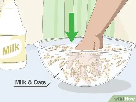 Imagen titulada Heal Dry Cracked Hands Step 3