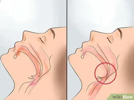 Imagen titulada Reduce Snoring Step 21