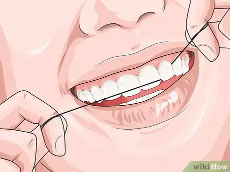 Imagen titulada Prevent Actinomycosis Step 1