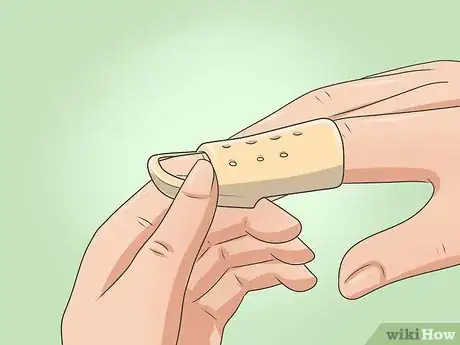 Imagen titulada Splint Trigger Finger Step 14