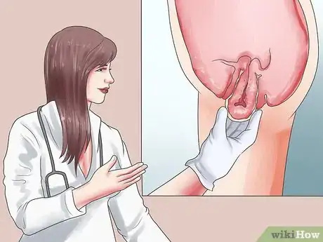 Imagen titulada Recognize Symptoms of a Postpartum Hemorrhage Step 2