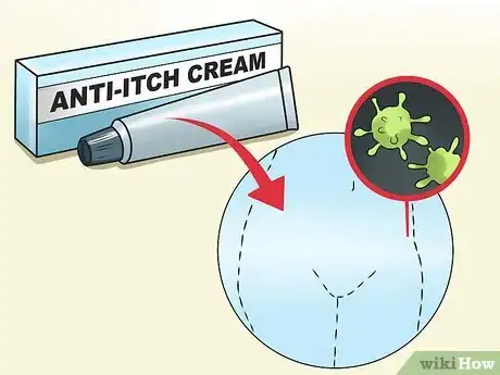 Imagen titulada Stop Vaginal Itching Step 4