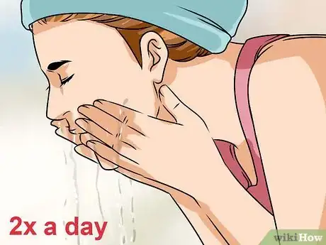 Imagen titulada Remove a Blackhead from Your Forehead Step 7